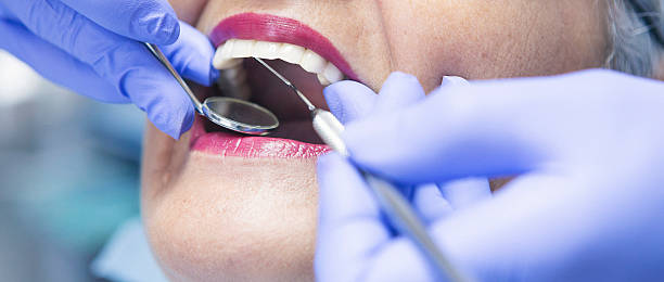 Best Emergency Root Canal Treatment in Sun City Center, FL